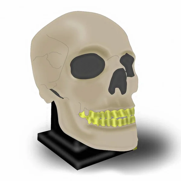 Human skull with gold teeth.