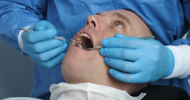 Klinice Szpital Lekarz Asystent Lekarza Sprawdza Zęby Pacjenta Leczeniu Tatarów — Wideo stockowe