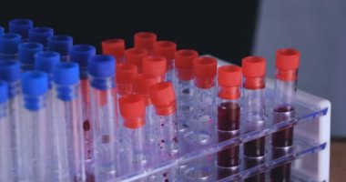 Laboratuar çalışması, Doktor bir pipet tutan, bir tıbbi maske ve gözlük, mavi kauçuk eldiven bir test tüpü bir test alır, analiz, kan, DNA, bir test tüp tutucu.