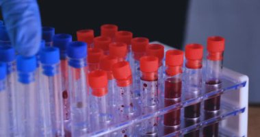 Laboratuar çalışması, Doktor bir pipet tutan, bir tıbbi maske ve gözlük, mavi kauçuk eldiven bir test tüpü bir test alır, analiz, kan, DNA, bir test tüp tutucu.