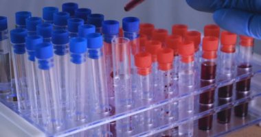 Laboratuar çalışması, Doktor bir pipet tutan, bir tıbbi maske ve gözlük, mavi kauçuk eldiven bir test tüpü bir test alır, analiz, kan, DNA, bir test tüp tutucu.