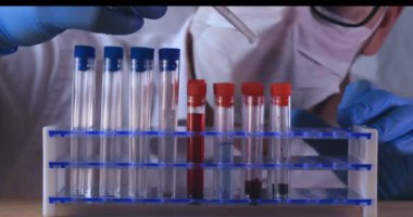 Laboratuar çalışması, Doktor bir pipet tutan, bir tıbbi maske ve gözlük, mavi kauçuk eldiven bir test tüpü bir test alır, analiz, kan, DNA, bir test tüp tutucu.