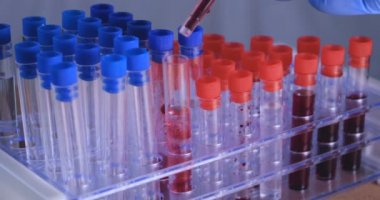 Laboratuar çalışması, Doktor bir pipet tutan, bir tıbbi maske ve gözlük, mavi kauçuk eldiven bir test tüpü bir test alır, analiz, kan, DNA, bir test tüp tutucu.