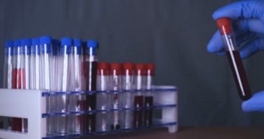 Laboratuar çalışması, Doktor bir pipet tutan, bir tıbbi maske ve gözlük, mavi kauçuk eldiven bir test tüpü bir test alır, analiz, kan, DNA, bir test tüp tutucu.