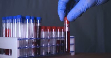 Laboratuar çalışması, Doktor bir pipet tutan, bir tıbbi maske ve gözlük, mavi kauçuk eldiven bir test tüpü bir test alır, analiz, kan, DNA, bir test tüp tutucu.