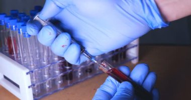 Laboratuar çalışması, Doktor bir pipet tutan, bir tıbbi maske ve gözlük, mavi kauçuk eldiven bir test tüpü bir test alır, analiz, kan, DNA, bir test tüp tutucu.