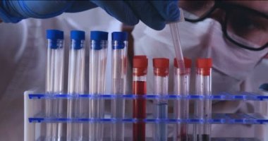 Laboratuar çalışması, Doktor bir pipet tutan, bir tıbbi maske ve gözlük, mavi kauçuk eldiven bir test tüpü bir test alır, analiz, kan, DNA, bir test tüp tutucu.