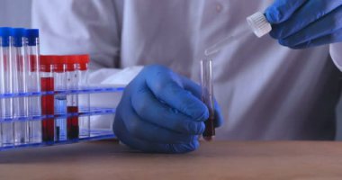 Laboratuar çalışması, Doktor bir pipet tutan, bir tıbbi maske ve gözlük, mavi kauçuk eldiven bir test tüpü bir test alır, analiz, kan, DNA, bir test tüp tutucu.