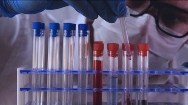 Laboratuvar çalışmaları, doktor bir şırınga tutar, tıbbi bir maske ve gözlük, mavi lastik eldiven, analiz, kan, Dna, bir test tüpü tutucu bir test tüpü bir test alır.