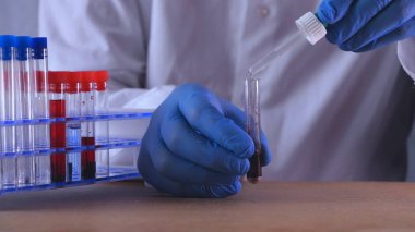 Laboratuvar çalışmaları, doktor bir şırınga tutar, tıbbi bir maske ve gözlük, mavi lastik eldiven, analiz, kan, Dna, bir test tüpü tutucu bir test tüpü bir test alır.