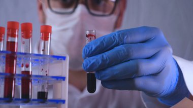 Laboratuvar çalışmaları, doktor bir şırınga tutar, tıbbi bir maske ve gözlük, mavi lastik eldiven, analiz, kan, Dna, bir test tüpü tutucu bir test tüpü bir test alır.