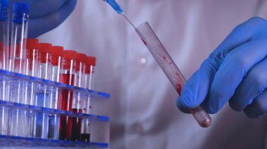 Laboratuvar çalışmaları, doktor bir şırınga tutar, tıbbi bir maske ve gözlük, mavi lastik eldiven, analiz, kan, Dna, bir test tüpü tutucu bir test tüpü bir test alır.