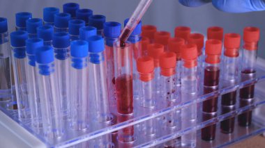 Laboratuvar çalışmaları, doktor bir şırınga tutar, tıbbi bir maske ve gözlük, mavi lastik eldiven, analiz, kan, Dna, bir test tüpü tutucu bir test tüpü bir test alır.