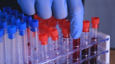 Laboratuvar çalışmaları, doktor bir şırınga tutar, tıbbi bir maske ve gözlük, mavi lastik eldiven, analiz, kan, Dna, bir test tüpü tutucu bir test tüpü bir test alır.