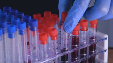 Laboratuvar çalışmaları, doktor bir şırınga tutar, tıbbi bir maske ve gözlük, mavi lastik eldiven, analiz, kan, Dna, bir test tüpü tutucu bir test tüpü bir test alır.