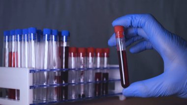 Laboratuvar çalışmaları, doktor bir şırınga tutar, tıbbi bir maske ve gözlük, mavi lastik eldiven, analiz, kan, Dna, bir test tüpü tutucu bir test tüpü bir test alır.