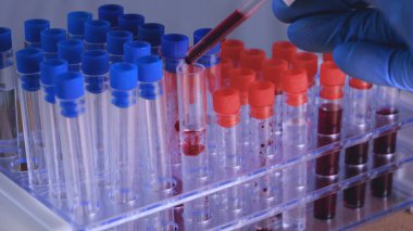 Laboratuvar çalışmaları, doktor bir şırınga tutar, tıbbi bir maske ve gözlük, mavi lastik eldiven, analiz, kan, Dna, bir test tüpü tutucu bir test tüpü bir test alır.