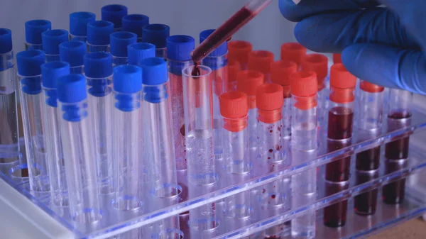 Laboratory work, the doctor holds a syringe, in a medical mask and glasses, takes a test from a test tube in blue rubber gloves, analysis, blood, DNA, a test tube holder.