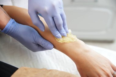 Şevval özçelik Güzellik Saç bir kadının elinden kaldırır. Sugaring. Epilasyon ile bir özel şeker hamur balmumu Depilasyon üzerinden pek çok avantajları vardır.