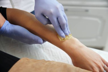 Şevval özçelik Güzellik Saç bir kadının elinden kaldırır. Sugaring. Epilasyon ile bir özel şeker hamur balmumu Depilasyon üzerinden pek çok avantajları vardır.