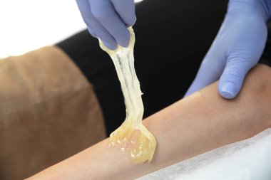 Şevval özçelik Güzellik Saç bir kadının elinden kaldırır. Sugaring. Epilasyon ile bir özel şeker hamur balmumu Depilasyon üzerinden pek çok avantajları vardır.