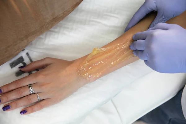 Schoonheidsspecialiste Verwijdert Haar Van Hand Van Een Vrouw Chaptalisatie Verwijdering — Stockfoto