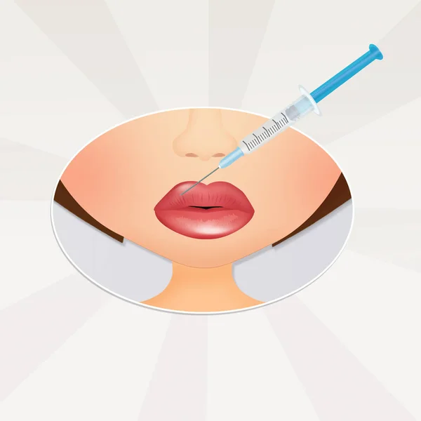 Hyaluronic Acid Lips Injection — Stock Photo, Image