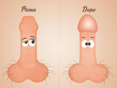 illustration of before and after circumcision clipart