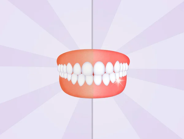 Illustration Mouth Clean Teeth — Stock Photo, Image