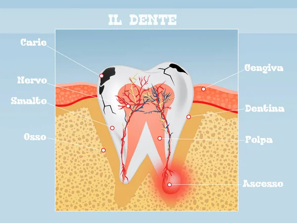 Illustration Schéma Dentaire — Photo