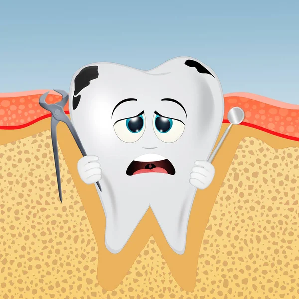 Illustration Tooth Caries Tartar — Stock Photo, Image