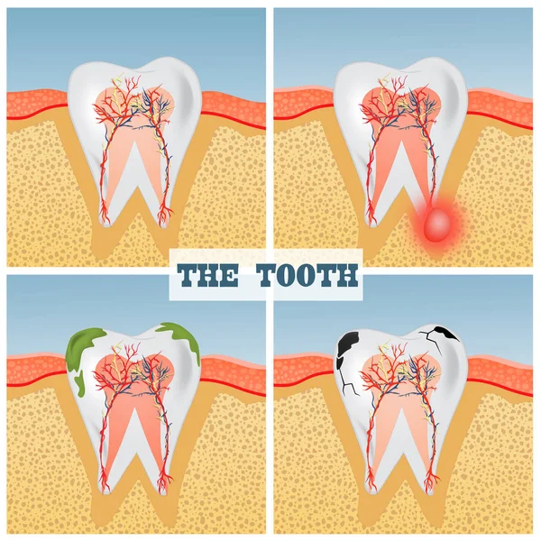 Illustration Tooth Anatomy — Stock Photo, Image