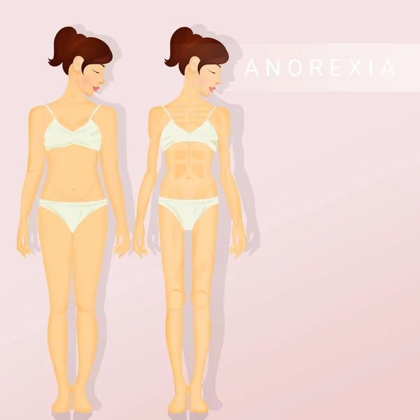 Illustrazione Anoressia Bulimia — Foto Stock