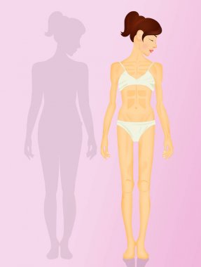 Anoreksiya ile kadın Illustration