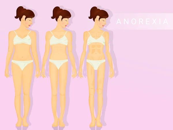 Ilustración Las Fases Niña Anorexia — Foto de Stock