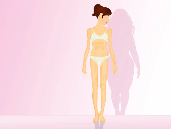 Ilustración Anorexia Bulimia — Foto de Stock