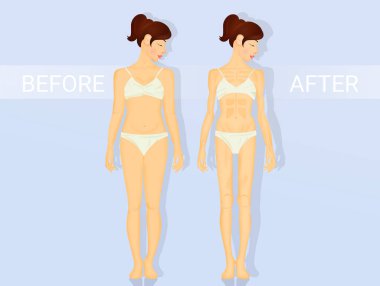 Anoreksiya ve bulimia aşamaları