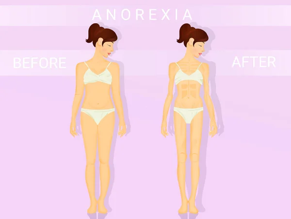 Illustratie Van Voor Anorexia — Stockfoto