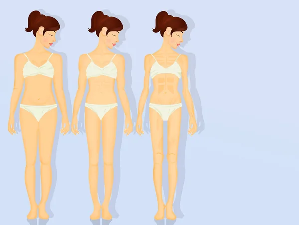 Illustrazione Delle Fasi Anoressia — Foto Stock