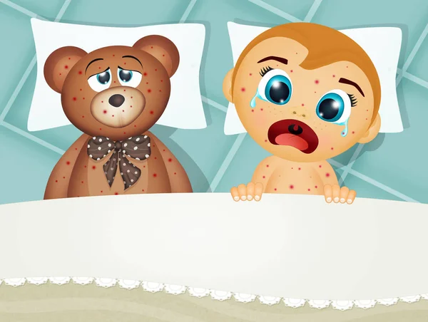 Baby Bed Measles Teddy Bear — Stock Photo, Image