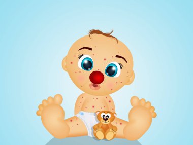 palyaço terapisi illüstrasyon