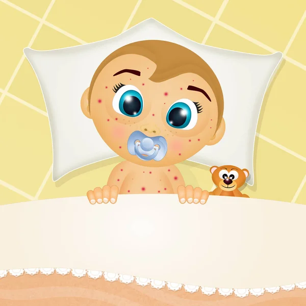 Baby Measles Bed — Stock Photo, Image