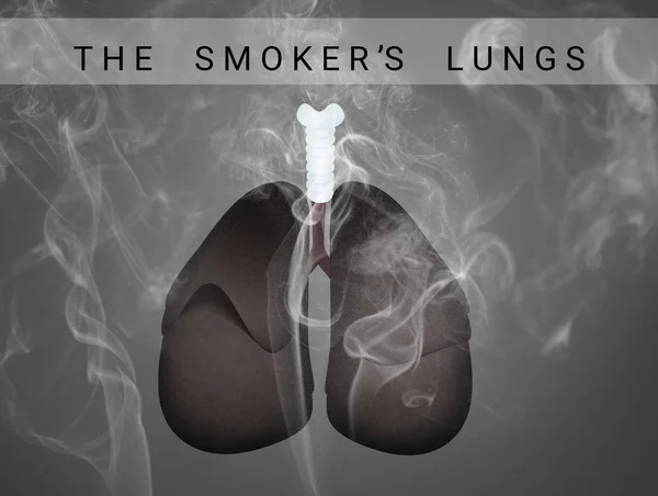 Ilustração Dos Pulmões Fumante — Fotografia de Stock