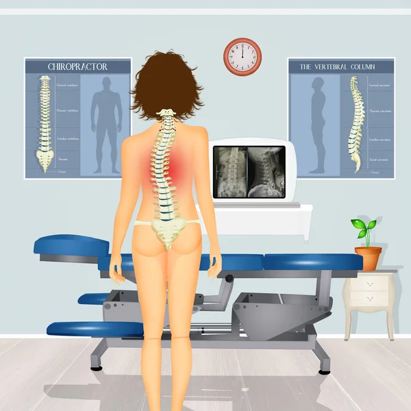 Illustration Girl Scoliosis Problem — Stock Photo, Image