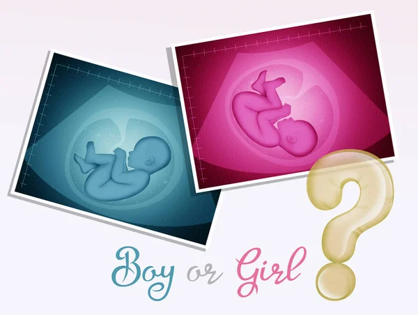 Illustration Gender Party Ultrasound Male Female — Stock Photo, Image