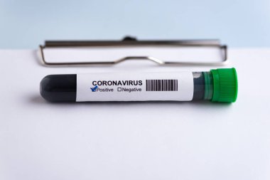 Panoda pozitif koronavirüs test tüpü var. Coronavirus koruma konsepti (COVID19).