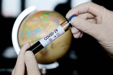 Dünya 'nın arka planında elinde Coperid-19 kan örneği olan test tüpü. Avrupa, Afrika ve Asya haritasına karşı negatif koronavirüs testi yapan doktor ya da bilim adamı