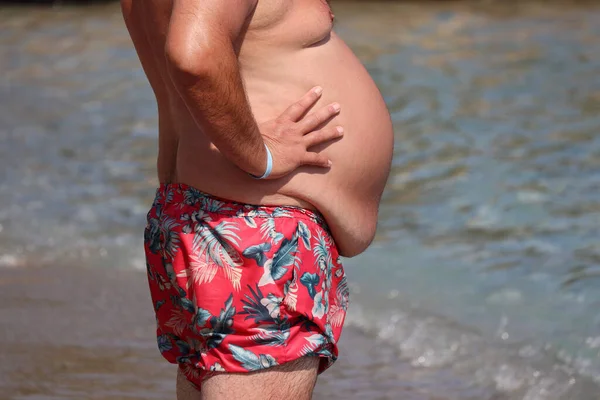 Man with fat belly standing on a beach. Overweight and obesity concept