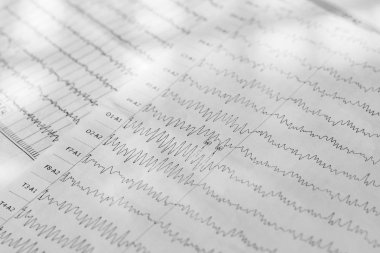 Kağıt yakın çekimde elektroensefalogram sonucu, beyin aktivitesi testi