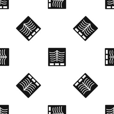 X ray fotoğraf model sorunsuz siyah